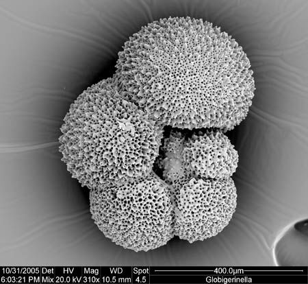 Globigerinella aequilateralis (umbilical)