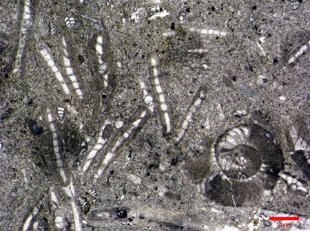 Operculinas (cortes longitudinales)